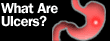 ulcers